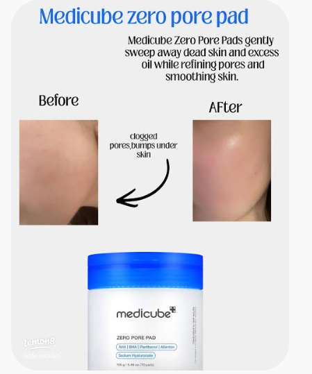 Medicube - Zero Pore Pad 2.0